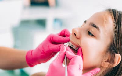 For Moms: How-To Guide To Preparing Your Child For A Dentist Visit