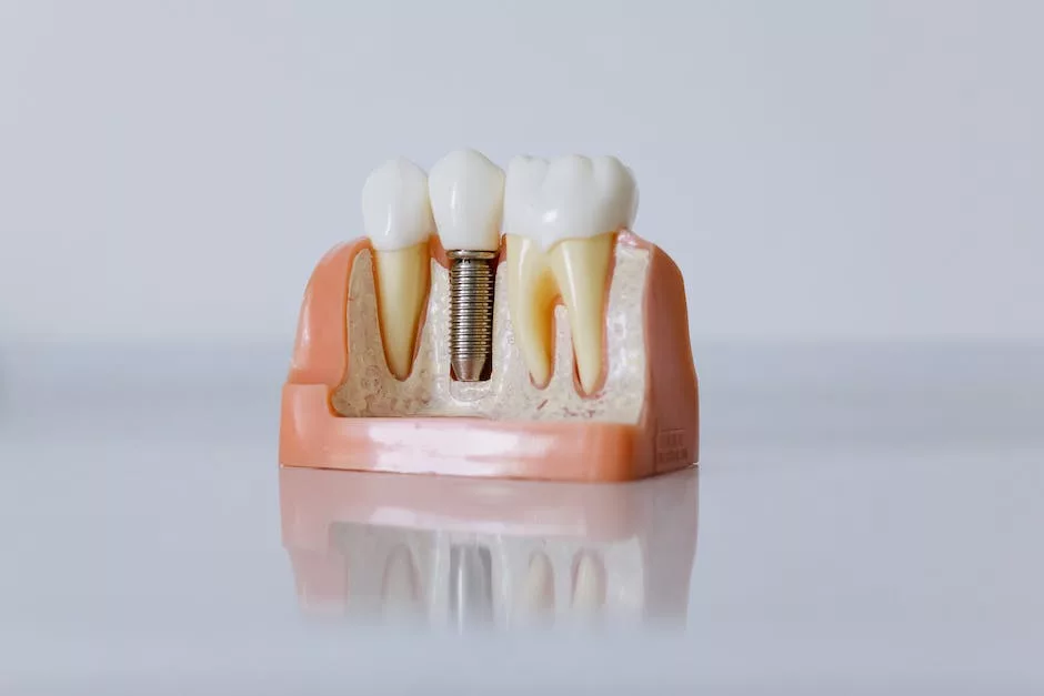 dental implant maintenance errors
