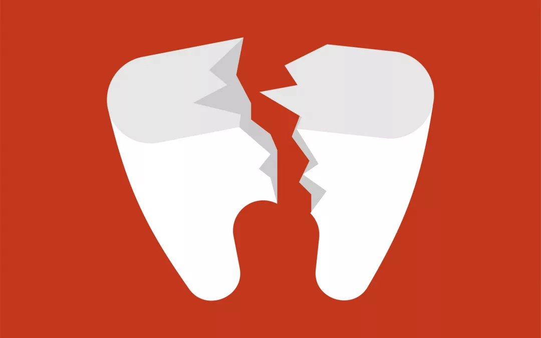 What to Do If You Have a Broken Tooth