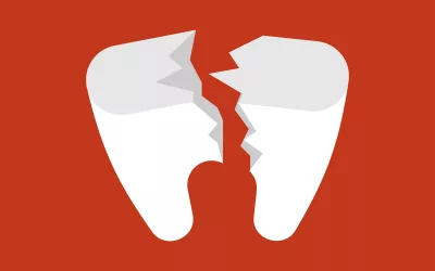 What to Do If You Have a Broken Tooth