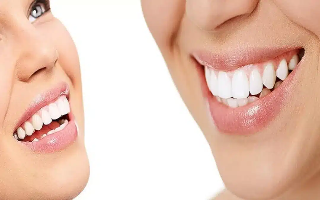 9 Tips for Choosing a Cosmetic Dentist