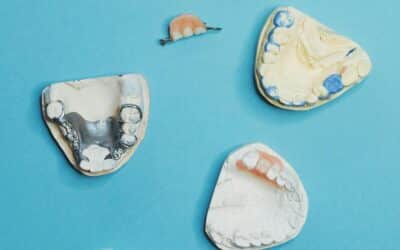 Dental Implants and Dentures: Choose the Right Path for Your Smile